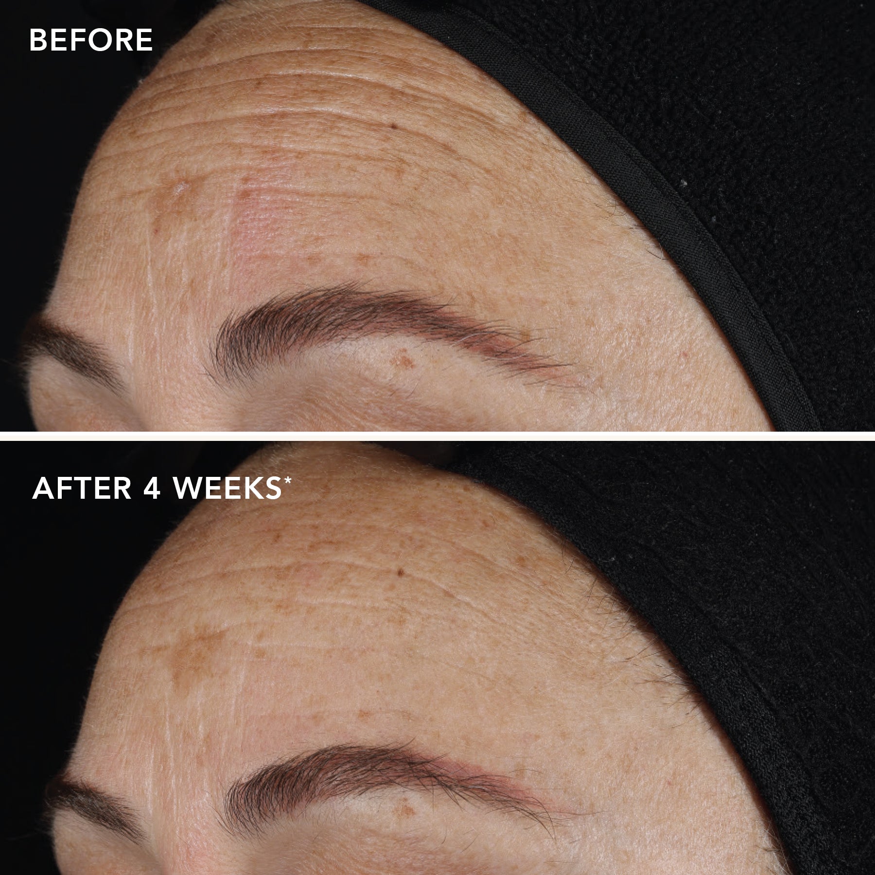 AGELESS+ A+ content testing