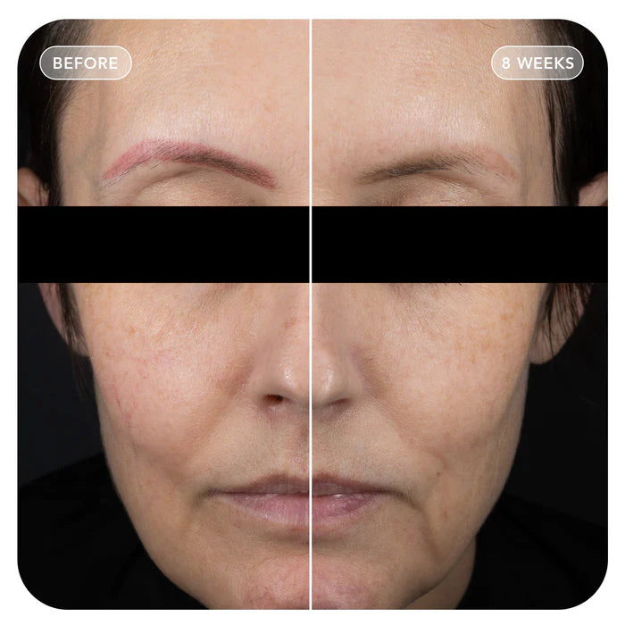 VolULift - TEST Product
