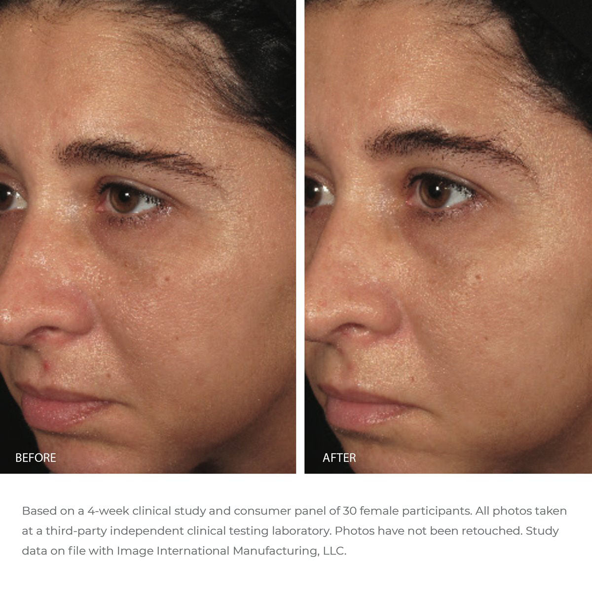 ORMEDIC® balancing biopeptide crème