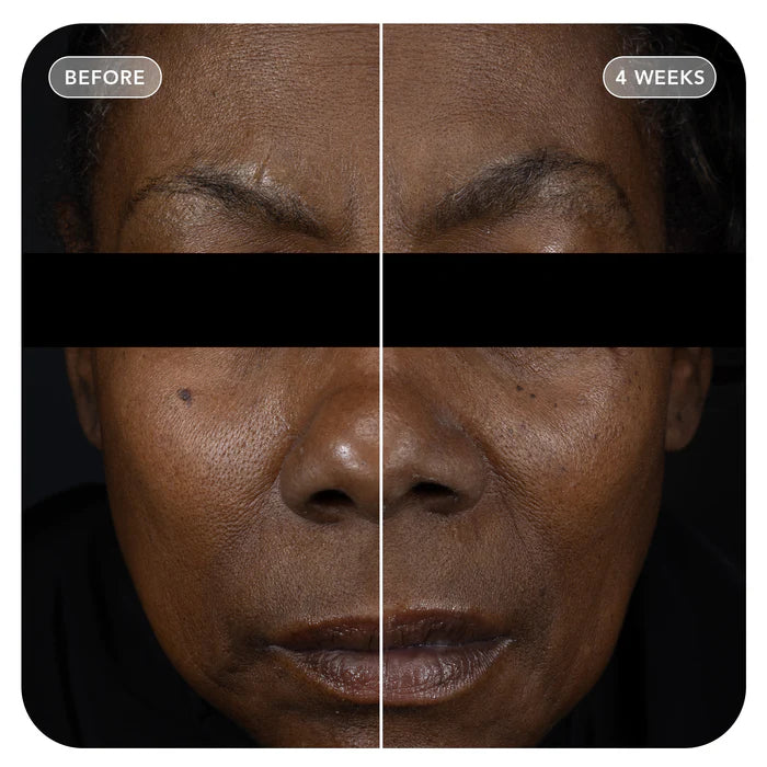 VolULift - TEST Product
