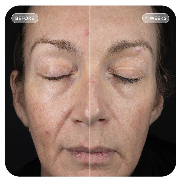 VolULift - TEST Product