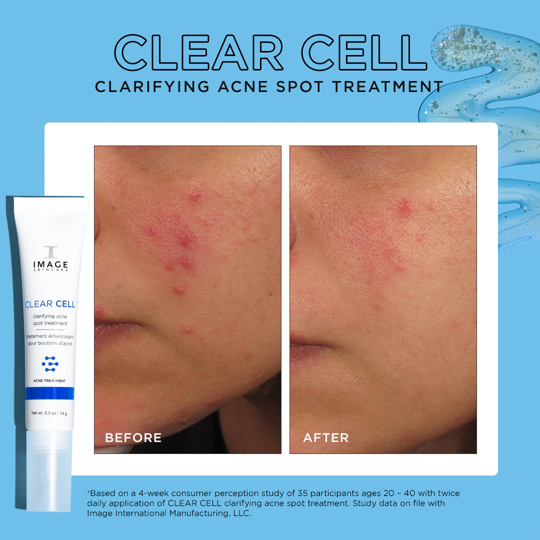 CLEAR CELL clarifying acne spot treatment